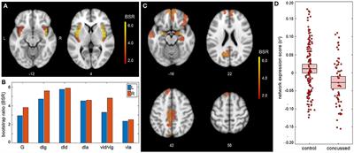 Insular Connectivity Is Associated With Self-Appraisal of Cognitive Function After a Concussion